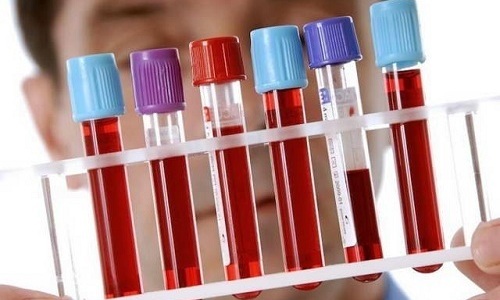 Для уточнения диагноза у ребенка выполняется анализ крови методом ПЦР и ИФА для определения типа вируса и наличия антител к нему