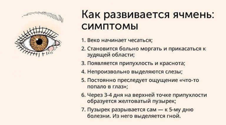 Признаки ячменя на глазу (начальная стадия): что делать, методы лечения