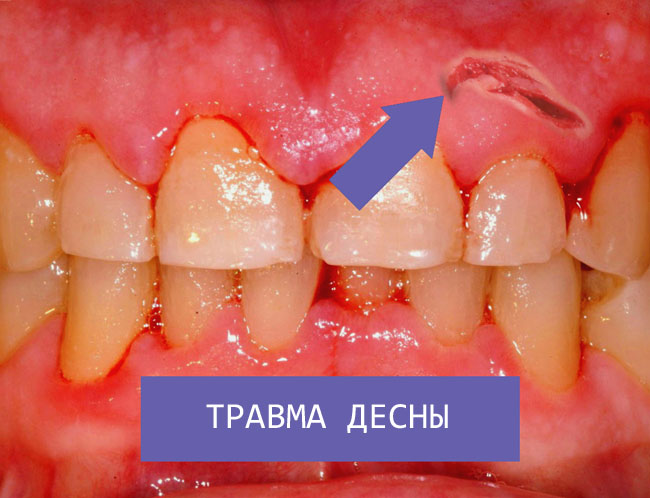 ТРАВМА ДЕСНЫ