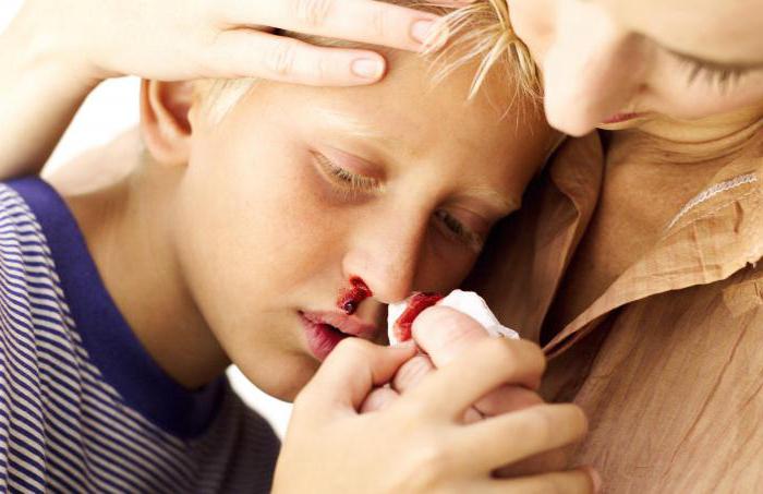 иммунная тромбоцитопения у детей
