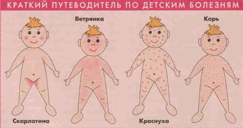 Разновидности инфекционной сыпи у детей
