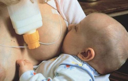 Система одновременной подачи грудного молока и смеси
