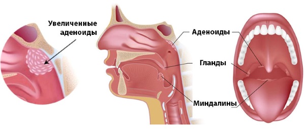 Синяки под глазами у ребенка: причины и лечение. Как избавиться в домашних условиях. Какие анализы сдать