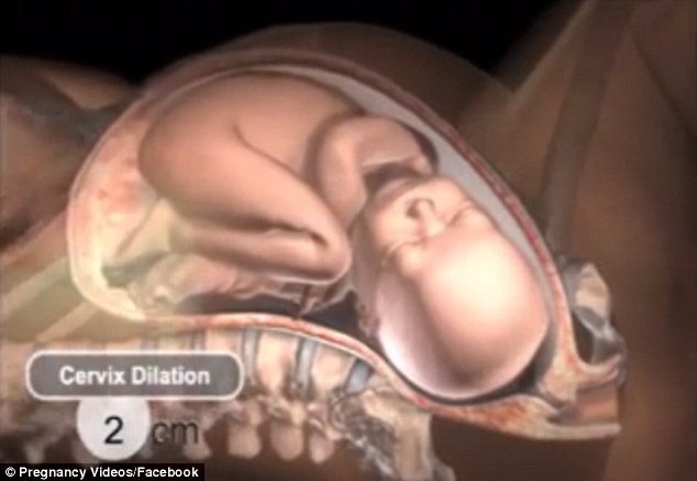 It shows how the cervix - the opening of the womb - begins to dilate as contractions strengthen