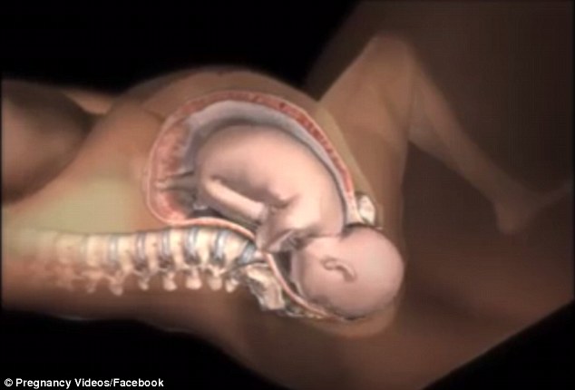 The head is typically delivered first, unless a baby is in the breech position where it