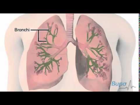 Причины, симптомы и способы лечения бронхиальной астмы