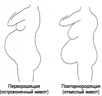 Форма живота во время беременности