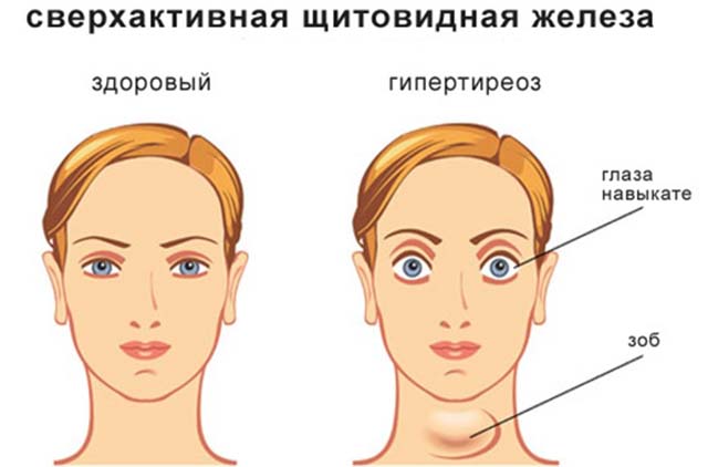 Эндокринная проблема