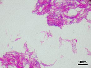 Mycobacterium bovis BCG ZN.jpg
