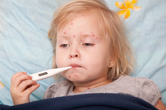 пищевая аллергия у детей